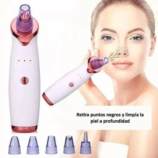 Extractor de Puntos Negros-PoreClean Pro®😱